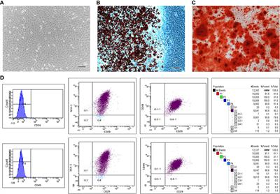 The p53/miR-145a Axis Promotes Cellular Senescence and Inhibits Osteogenic Differentiation by Targeting Cbfb in Mesenchymal Stem Cells